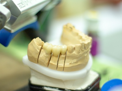 Zobu protezēšana